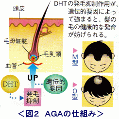 イラスト（ＡＧＡの仕組み）