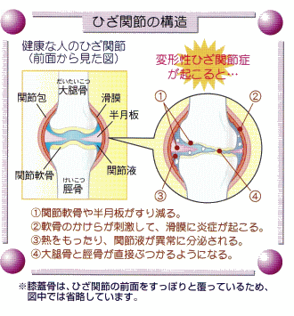図（ひざ関節の構造）