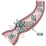 画像（経絡の流れが悪くなる原因１）