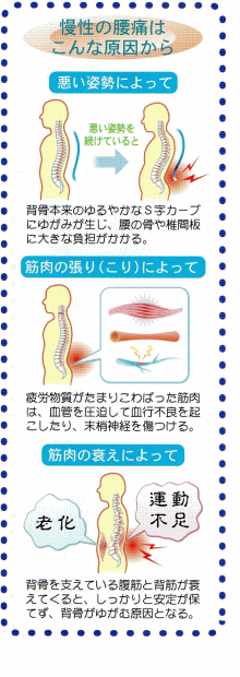 図（腰痛の原因）