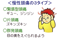 イラスト（慢性頭痛の３タイプ）